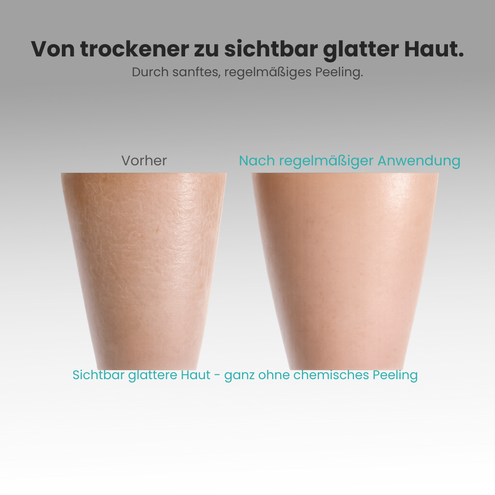 VitalTowel – Sanftes, hygienisches Peeling für Rücken & Körper